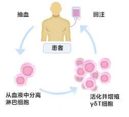 日本γδT細胞療法